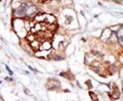 TTK Antibody in Immunohistochemistry (IHC)