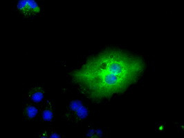 TTLL12 Antibody in Immunocytochemistry (ICC/IF)