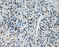TTLL12 Antibody in Immunohistochemistry (Paraffin) (IHC (P))