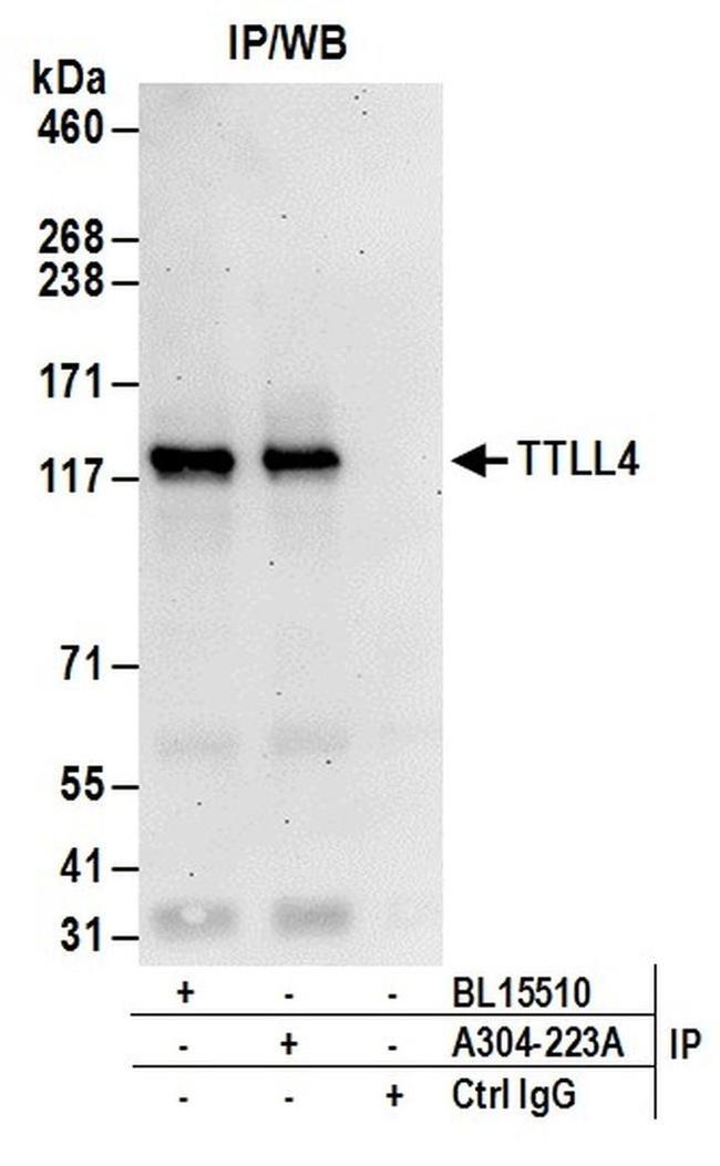 TTLL4 Antibody in Western Blot (WB)