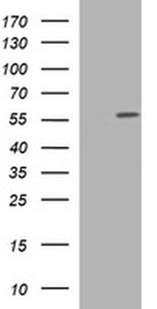 TUBA1C Antibody in Western Blot (WB)
