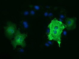 TUBA3E Antibody in Immunocytochemistry (ICC/IF)