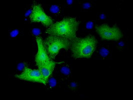 TUBA3E Antibody in Immunocytochemistry (ICC/IF)