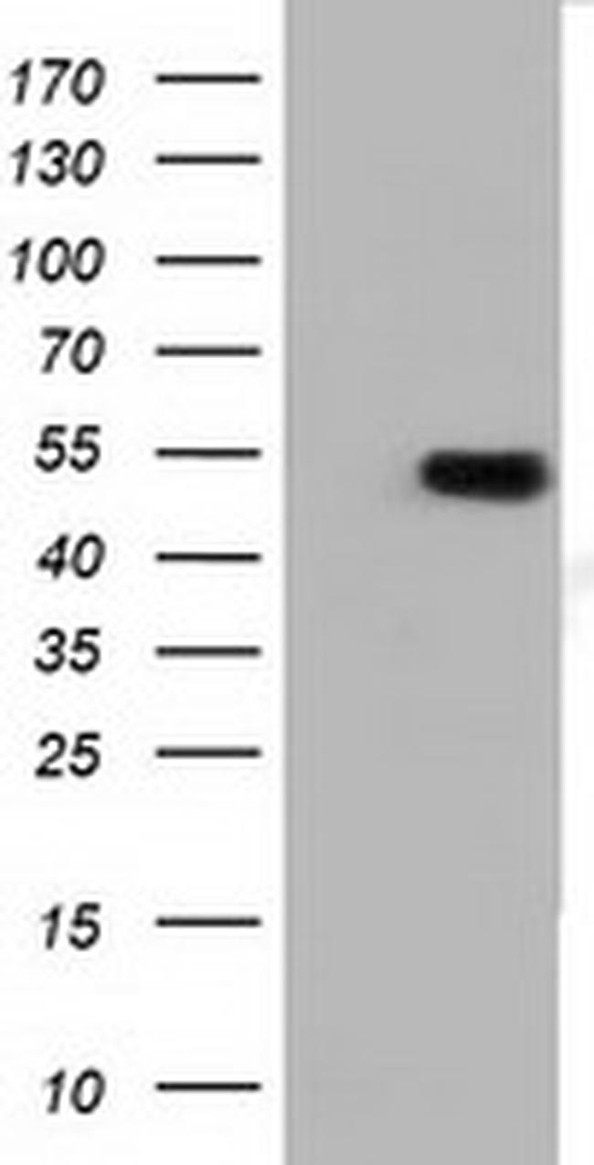 TUBA3E Antibody in Western Blot (WB)