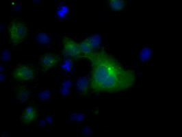 TUBA8 Antibody in Immunocytochemistry (ICC/IF)