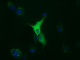 TUBA8 Antibody in Immunocytochemistry (ICC/IF)
