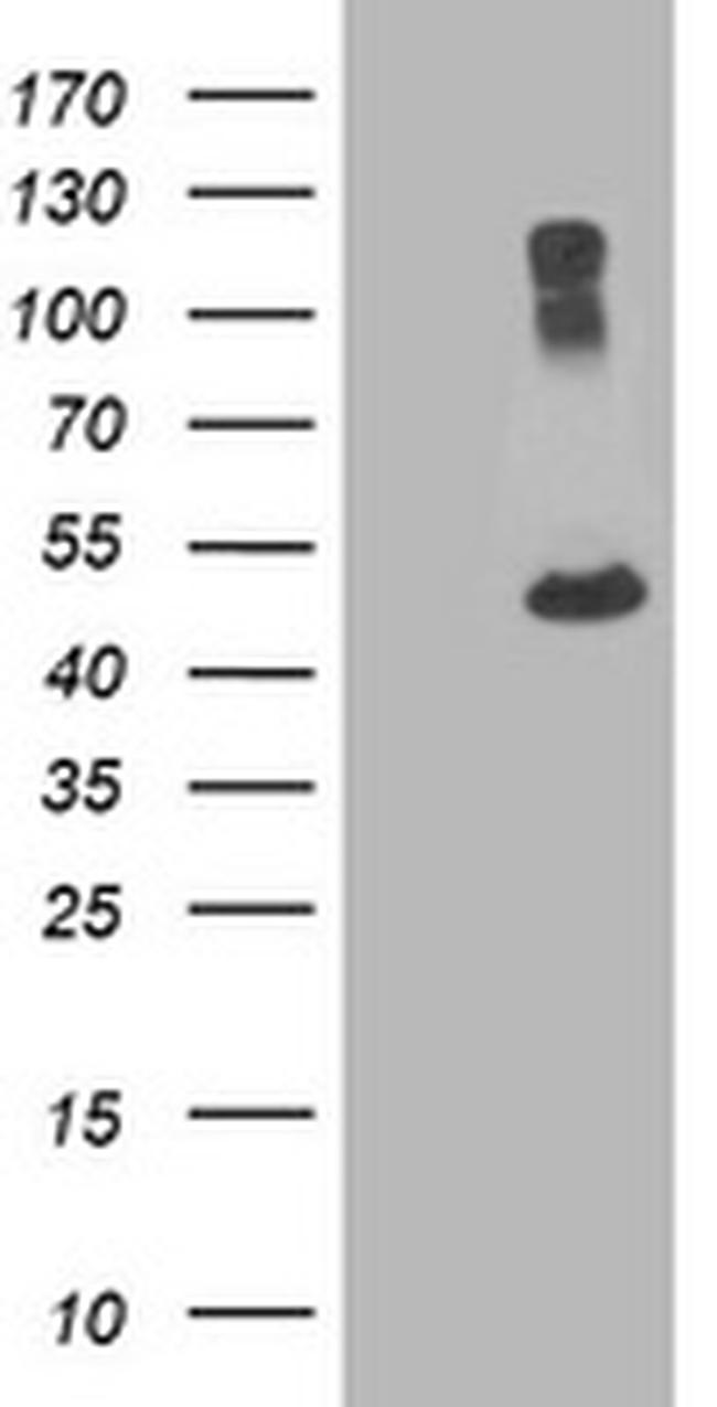 TUBA8 Antibody in Western Blot (WB)