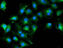 TUBAL3 Antibody in Immunocytochemistry (ICC/IF)
