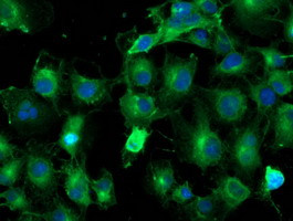TUBAL3 Antibody in Immunocytochemistry (ICC/IF)