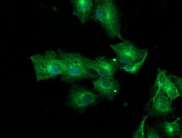 TUBAL3 Antibody in Immunocytochemistry (ICC/IF)