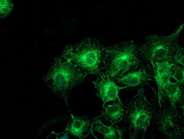 TUBAL3 Antibody in Immunocytochemistry (ICC/IF)