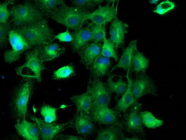 TUBAL3 Antibody in Immunocytochemistry (ICC/IF)