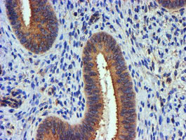 TUBAL3 Antibody in Immunohistochemistry (Paraffin) (IHC (P))