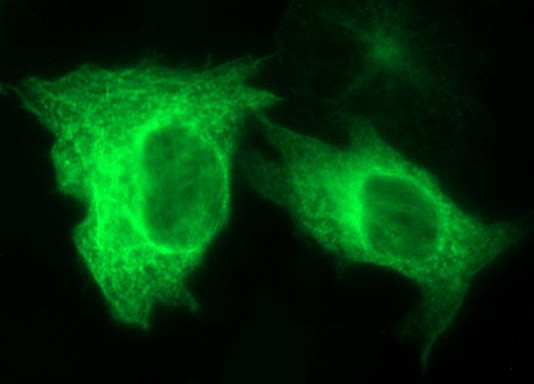 TUBB2A Antibody in Immunocytochemistry (ICC/IF)