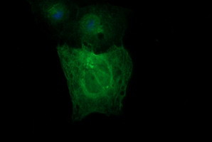 TUBB2A Antibody in Immunocytochemistry (ICC/IF)