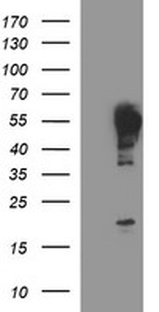 TUBB2A Antibody in Western Blot (WB)
