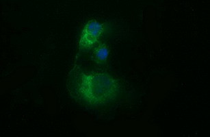 TUBB2B Antibody in Immunocytochemistry (ICC/IF)