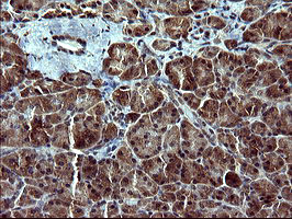 TUBB2B Antibody in Immunohistochemistry (Paraffin) (IHC (P))
