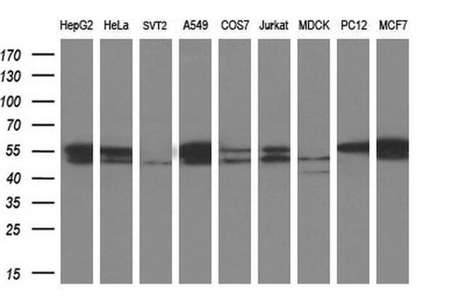 TUBB3 Antibody in Western Blot (WB)