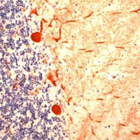 gamma Tubulin Antibody in Immunohistochemistry (IHC)