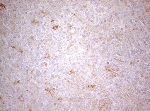 TWF1 Antibody in Immunohistochemistry (Paraffin) (IHC (P))
