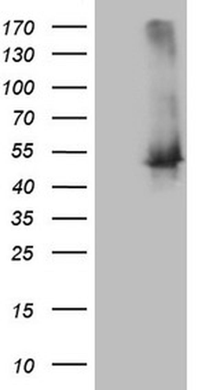 TWF1 Antibody in Western Blot (WB)
