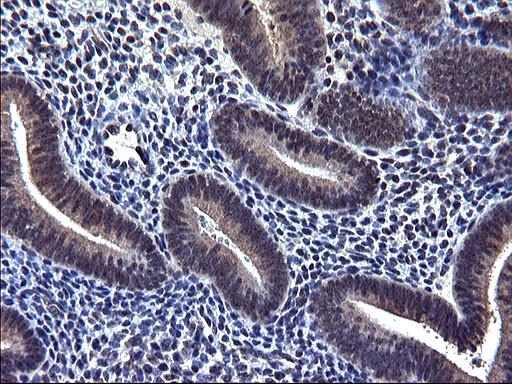 TXNDC5 Antibody in Immunohistochemistry (Paraffin) (IHC (P))