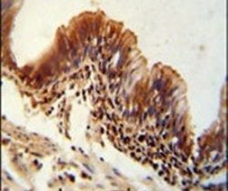 TXNDC6 Antibody in Immunohistochemistry (IHC)