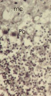 TXNL1 Antibody in Immunohistochemistry (IHC)