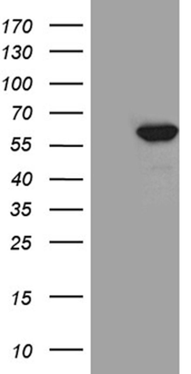 TXNRD1 Antibody in Western Blot (WB)
