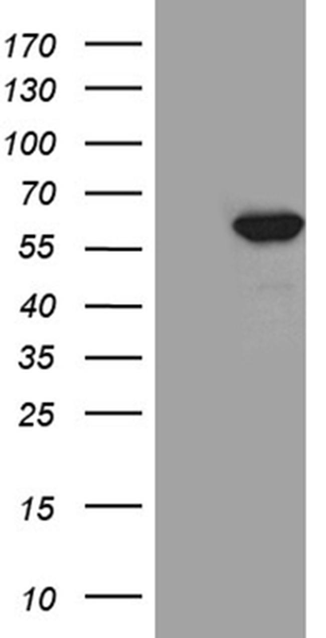 TXNRD1 Antibody in Western Blot (WB)