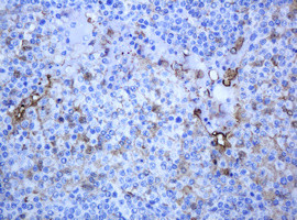 TYMP Antibody in Immunohistochemistry (Paraffin) (IHC (P))
