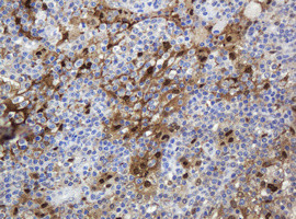 TYMP Antibody in Immunohistochemistry (Paraffin) (IHC (P))