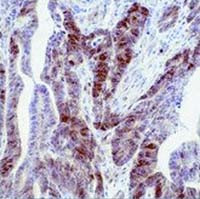Thymidylate Synthase Antibody in Immunohistochemistry (IHC)