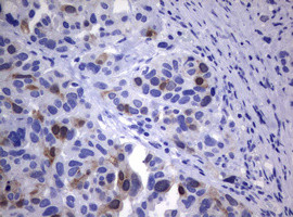 TYMS Antibody in Immunohistochemistry (Paraffin) (IHC (P))