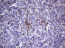 TYMS Antibody in Immunohistochemistry (Paraffin) (IHC (P))