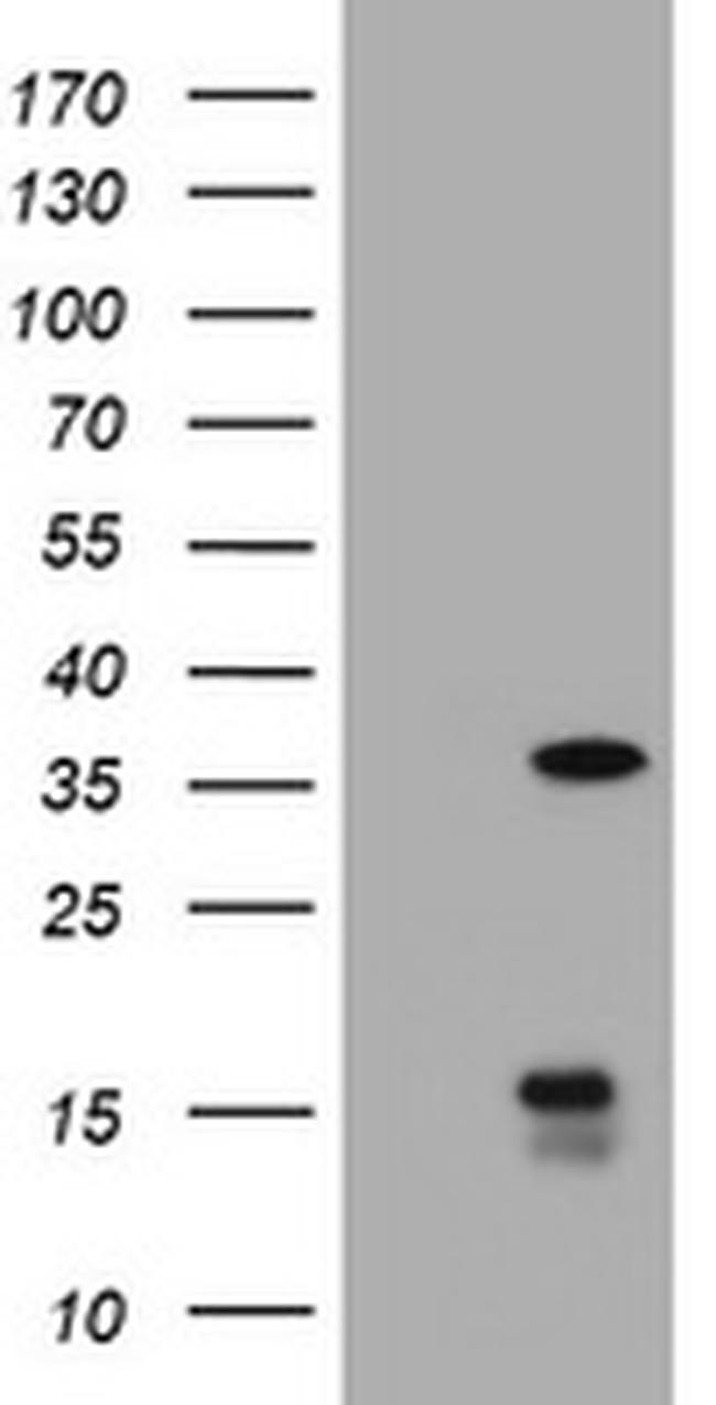 TYMS Antibody in Western Blot (WB)