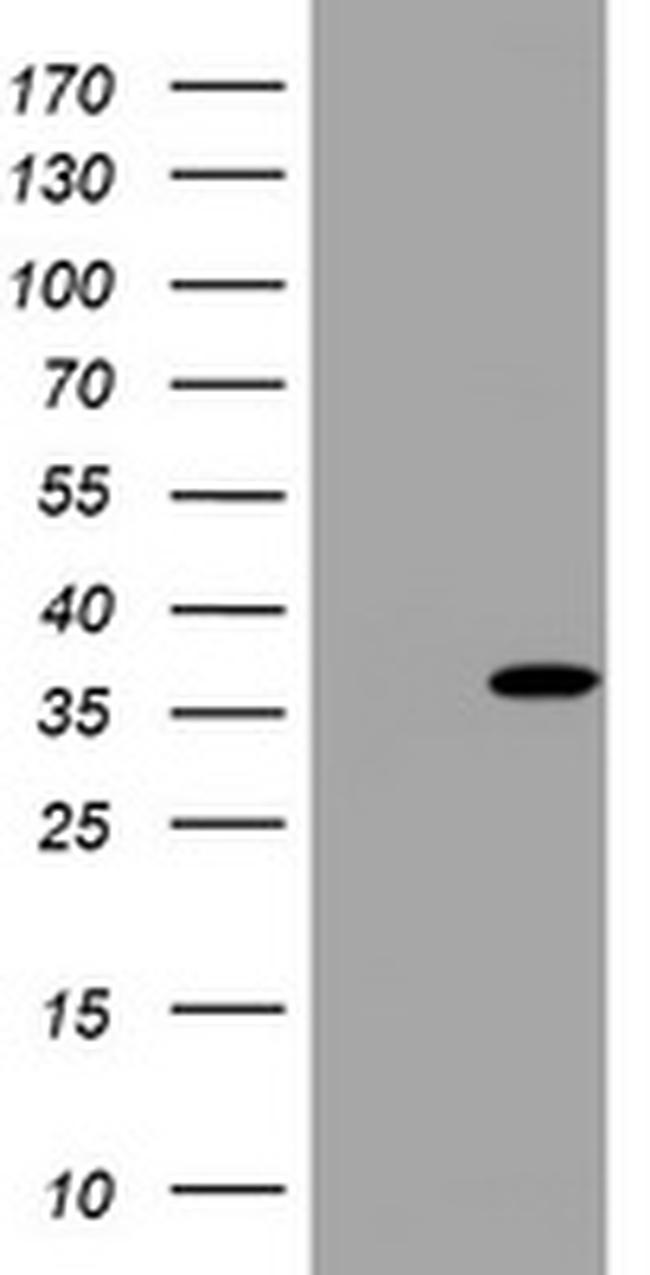 TYMS Antibody in Western Blot (WB)