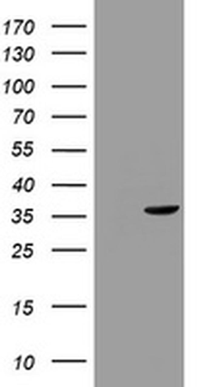 TYMS Antibody in Western Blot (WB)