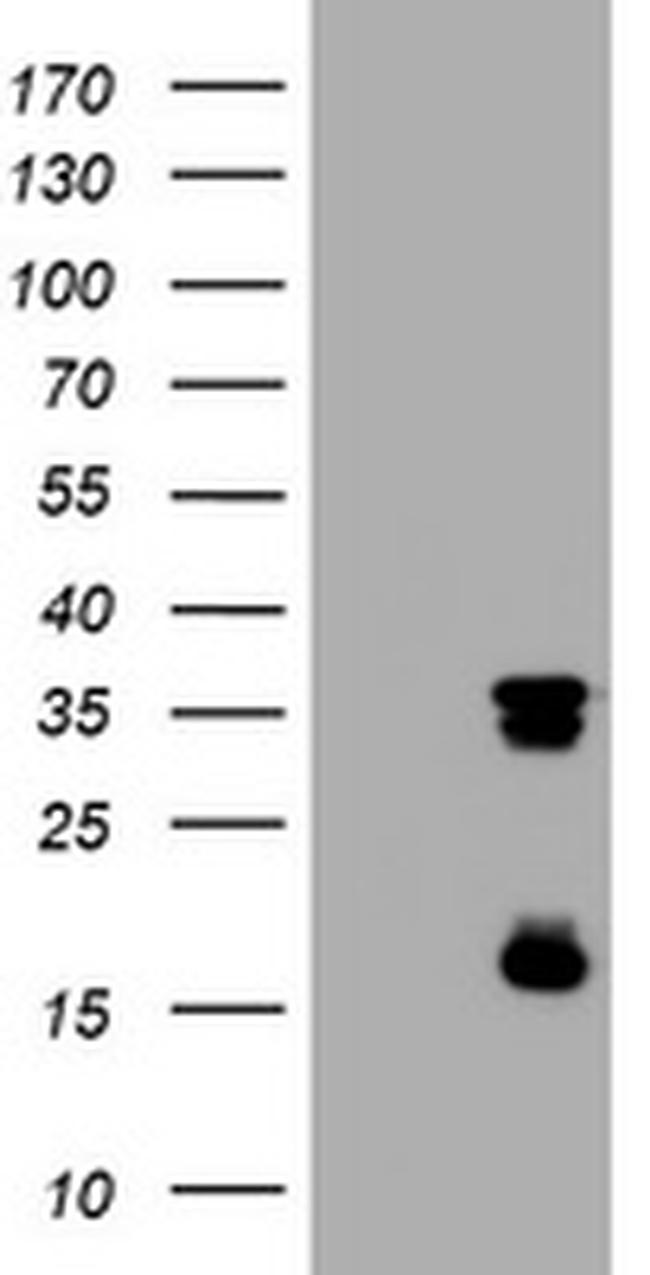 TYMS Antibody in Western Blot (WB)