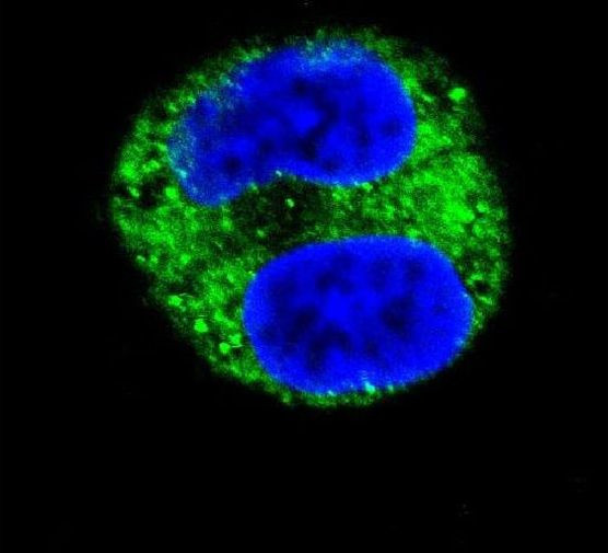 Tyrosinase Antibody in Immunocytochemistry (ICC/IF)