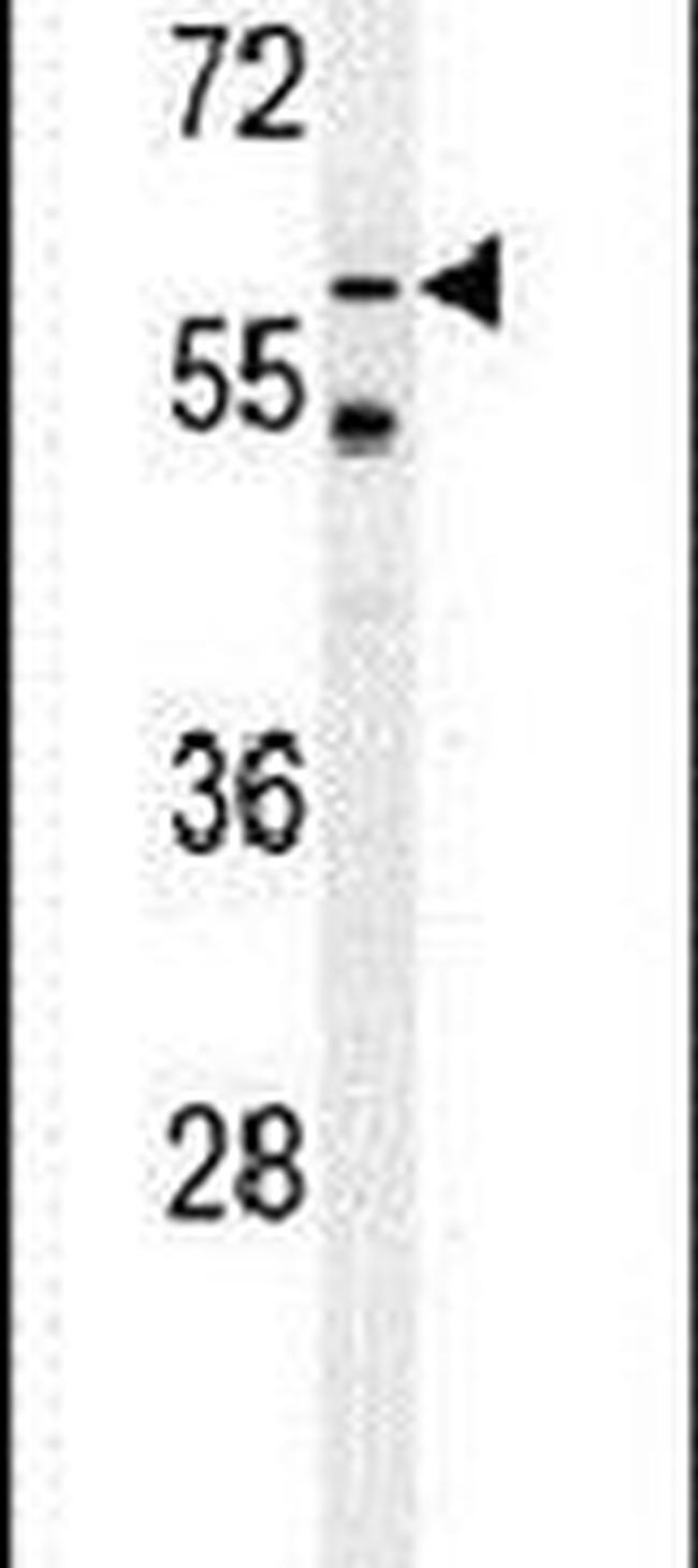 TYSND1 Antibody in Western Blot (WB)