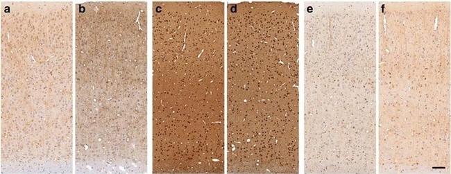 Phospho-Tau (Thr212, Ser214) Antibody in Immunohistochemistry (Paraffin) (IHC (P))