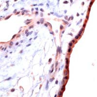 TGF beta-1 Antibody in Immunohistochemistry (IHC)