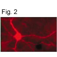 Phospho-Tyrosine Hydroxylase (Ser40) Antibody in Immunohistochemistry (IHC)