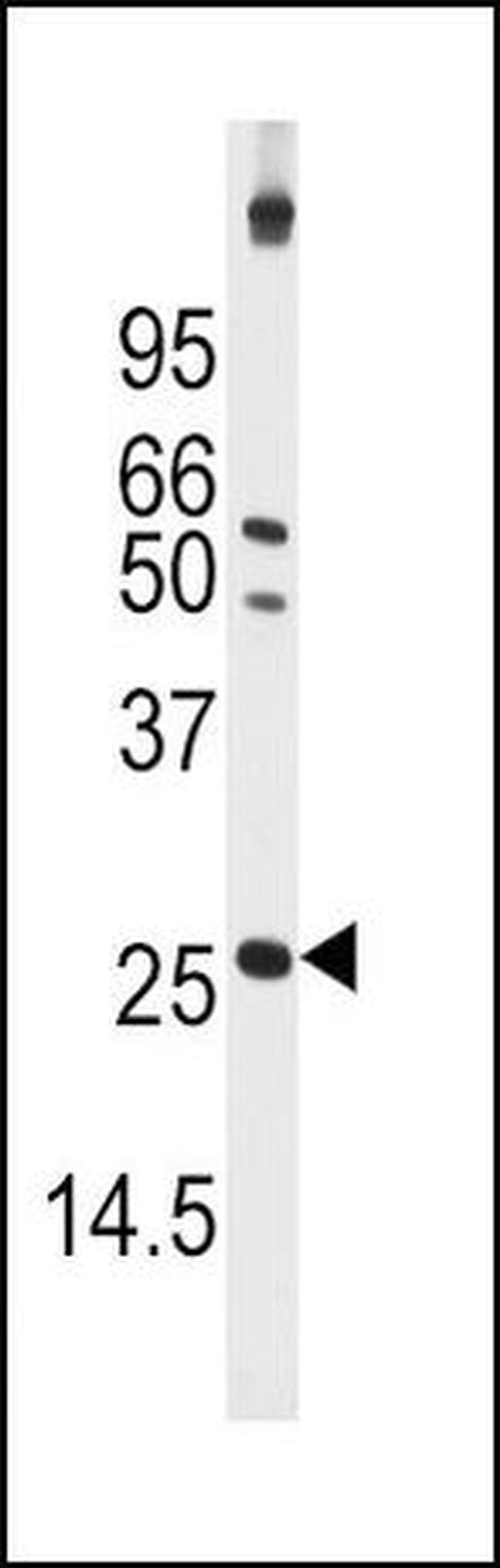 Thioredoxin 2 Antibody in Western Blot (WB)