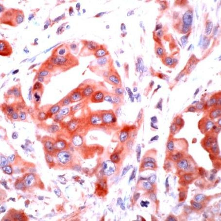 PAR1 Antibody in Immunohistochemistry (Paraffin) (IHC (P))
