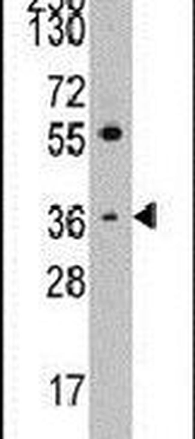 Thrombopoietin Antibody in Western Blot (WB)