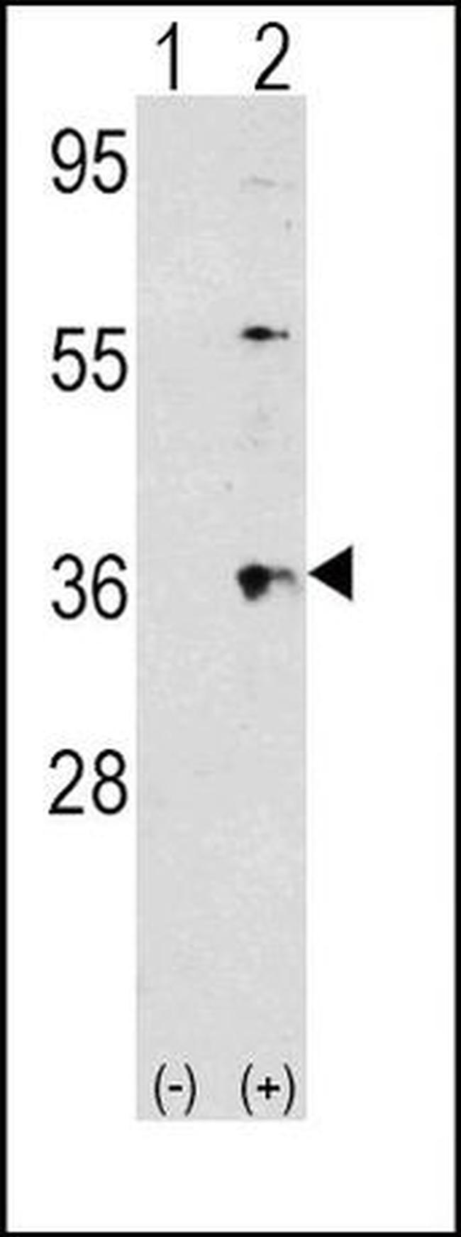 Thrombopoietin Antibody in Western Blot (WB)