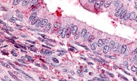 TBXA2R Antibody in Immunohistochemistry (Paraffin) (IHC (P))